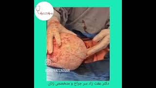 جراحی توده در شکم دکتر عفت زادسرجراح و متخصص زنان و زایمان،تهران
