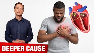 The Root Cause of Cardiac Arrhythmias Is... (MUST WATCH)