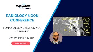 Temporal Bone Anatomy on CT Imaging w/ Dr. David Yousem - Medality (MRI Online) Radiology Conference