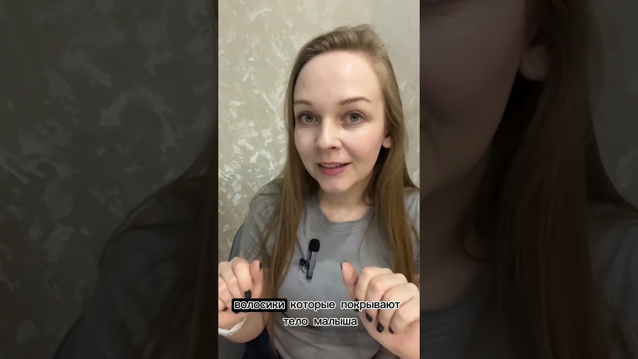 Щетина/ кочерга новорожденных. Что это?