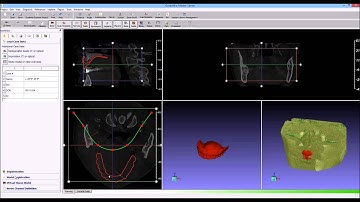 guidemia dual scan 01 load data segmentation registration mp4