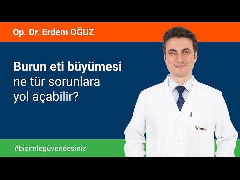 Burun eti büyümesi
