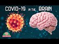 How covid19 affects the brain