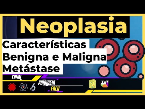 Vídeo: Neoplasia maligna - características, tipos, sintomas, tratamento
