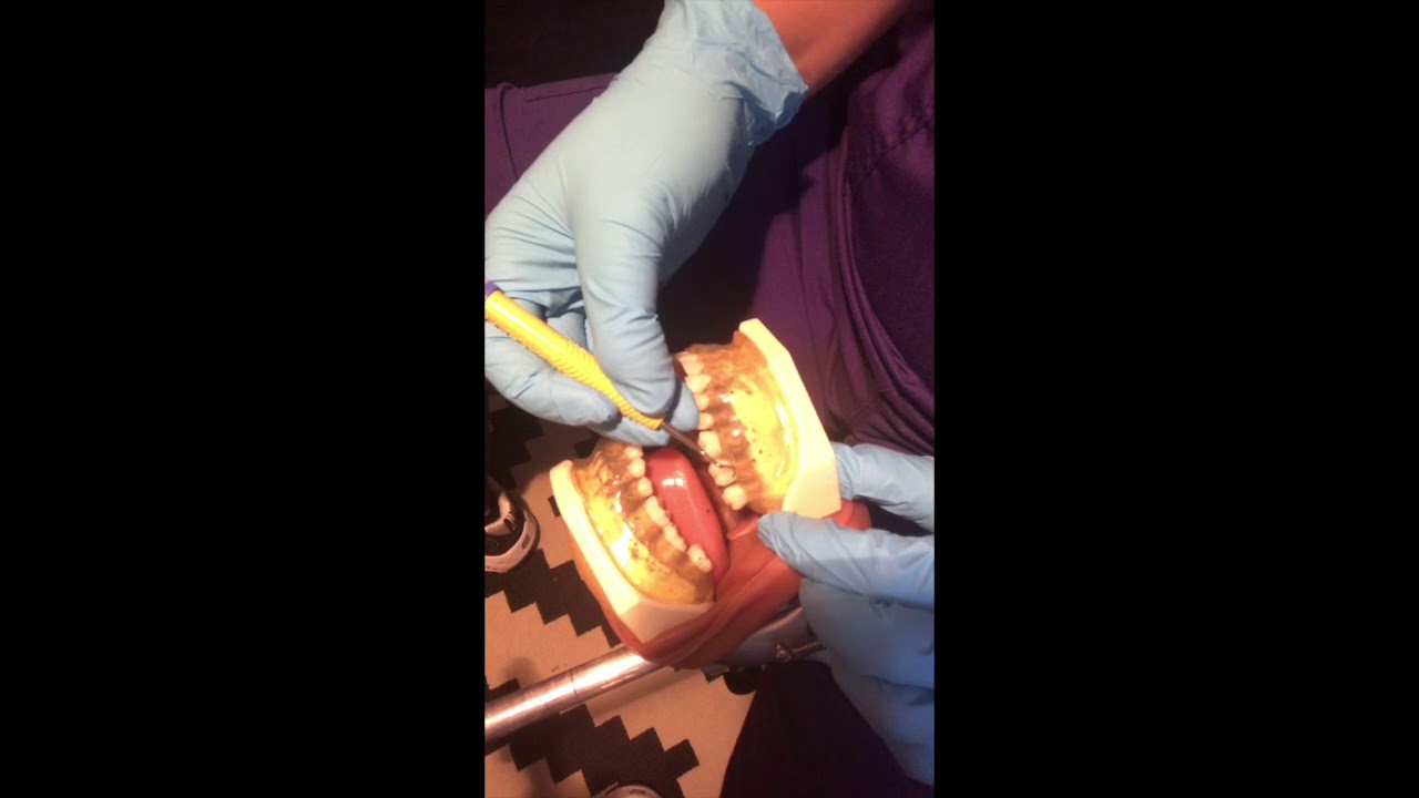 Dental Hygiene Instrumentation Skills YouTube