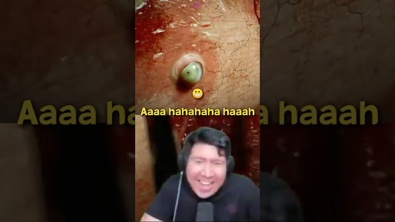 KETAWA VILLAIN BANG WINDAH 😫 