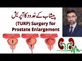 Prostrate gland surgery turp  dr shoaib mithani