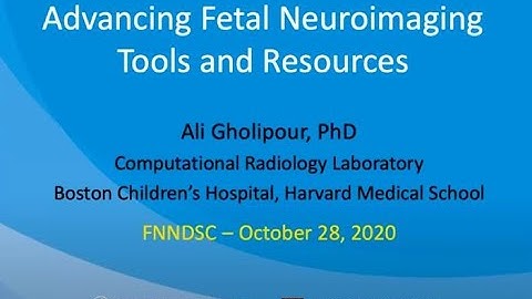 FNNDSC Lecture Series with Guest Speaker: Ali Gholipour, PhD