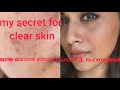 Acne മാറാ൯ ഞാ൯ ചെയ്ത 3 tips/ 3 simple tips for clear and glowing skin