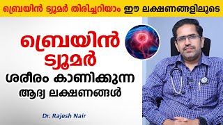 ബ്രെയിൻ ട്യൂമർ ശരീരം കാണിക്കുന്ന ആദ്യ ലക്ഷണങ്ങൾ | Brain Tumor Malayalam | Arogyam