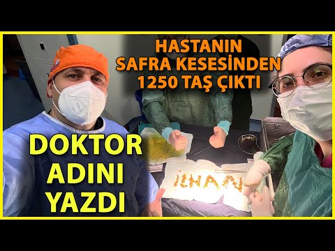 Safra Kesesinden 1250 Taş Çıktı, Doktor İsmini Yazdı