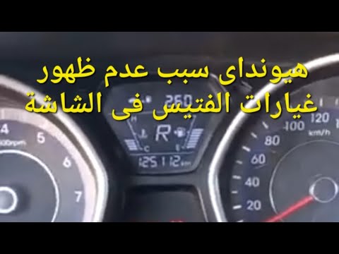 هيونداى النترا وافانتى مشكلة دبة او رزعة فى الفتيس وعدم ظهور احرف الغيارات   