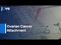 Ovarian Cancer Attachment and Mesothelial Cells Invasion: Real Time | Protocol Preview