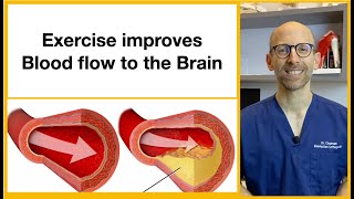Best exercises to improve blood flow to the brain