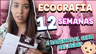 ECOGRAFÍA 12 SEMANAS  ¿Sabemos el SEXO del BEBÉ? + REACCIÓN de las HERMANAS