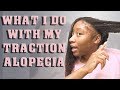 I have traction alopecia and what i do to hide it.