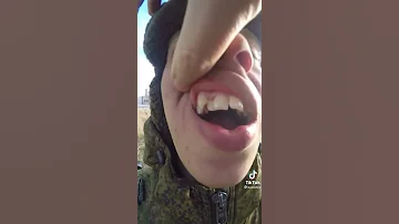 ЖЕСТЬ ЗУБЫ РАСТУТ В ДВА РЯДА🤯😱❌🔞