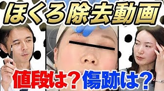 ほくろ除去 Youtube