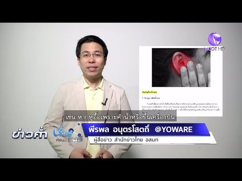 วีดีโอ: 10 วิธีในการกำจัดอาการปวดหู