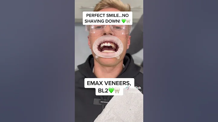 Primo Dental! Emax Veneers Loose Fit Try On Test! #shorts