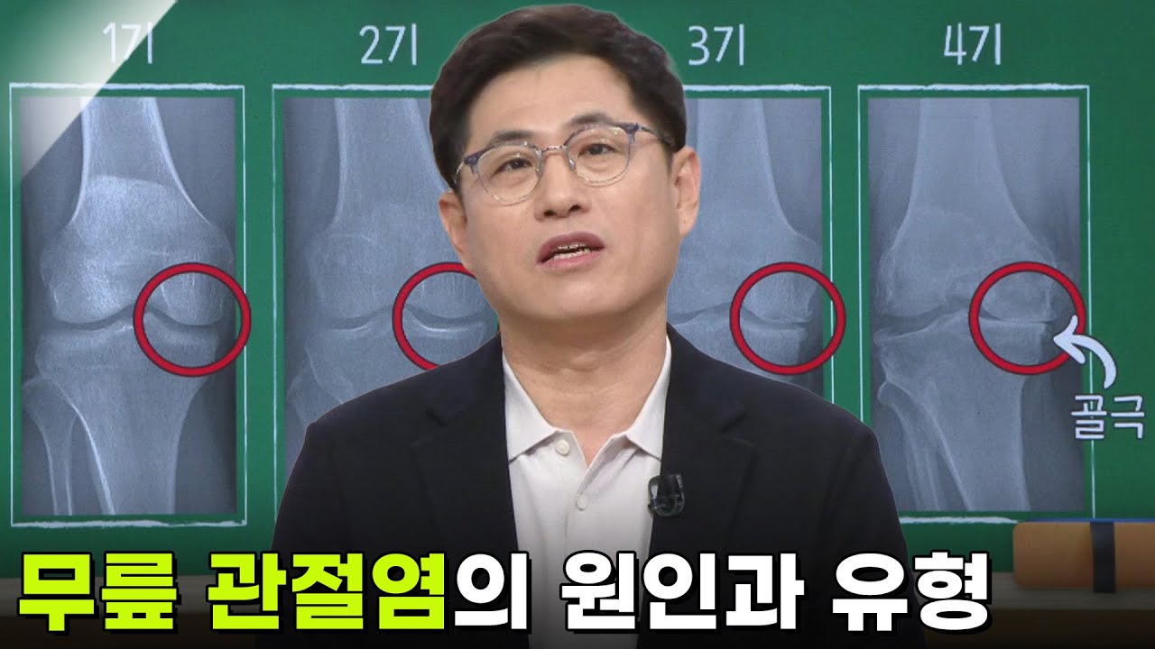 김영모 정형외과 교수, 일상을 힘들게 하는 ‘무릎 관절염’ [아침마당] | KBS 260305 방송