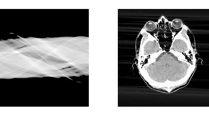 Filtered back-projection reconstruction of head slice - DayDayNews