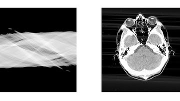 Filtered back-projection reconstruction of head slice
