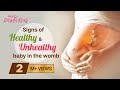 Signs of healthy and unhealthy baby in the womb