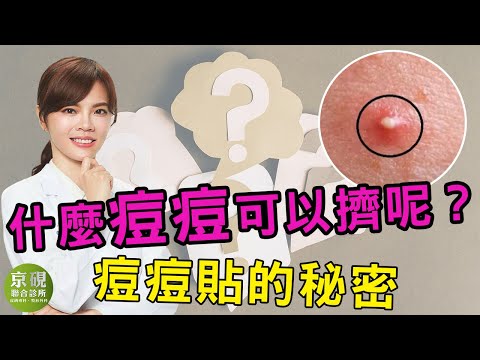 什麼痘痘可以擠?痘痘貼的秘密