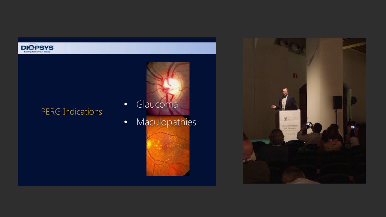 EGS 2018 - Early diagnosis of Glaucoma with Pattern ERG