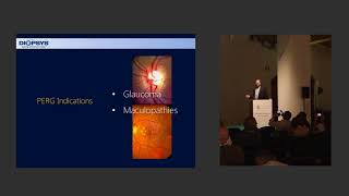 EGS 2018 - Early diagnosis of Glaucoma with Pattern ERG