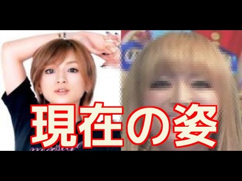 【衝撃】浜崎あゆみの酷すぎる現在。顔も歌声も劣化したと話題に。　「ジャニーズｃｈ」