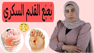 خطورة القدم السكري وكيفية الوقايه منه | دكتور إيمان رمضان