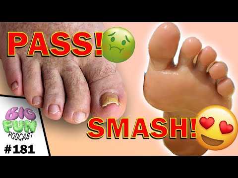 Feet BigFunPodcast 181 