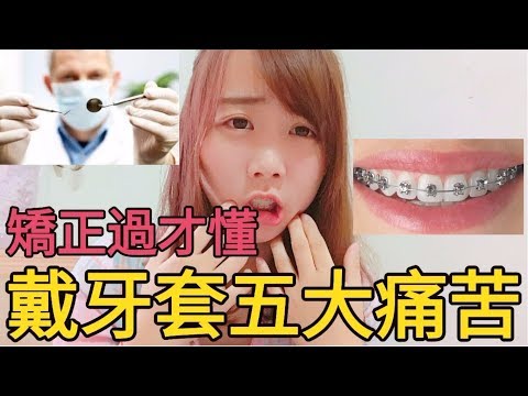 矯正過才懂！戴牙套必經歷的五大痛苦｜那個女生Kiki