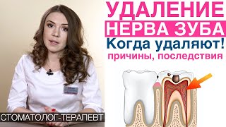 Удаление нерва зуба, пульпит, пломбирование каналов зуба. Можно ли спасти зубной нерв?