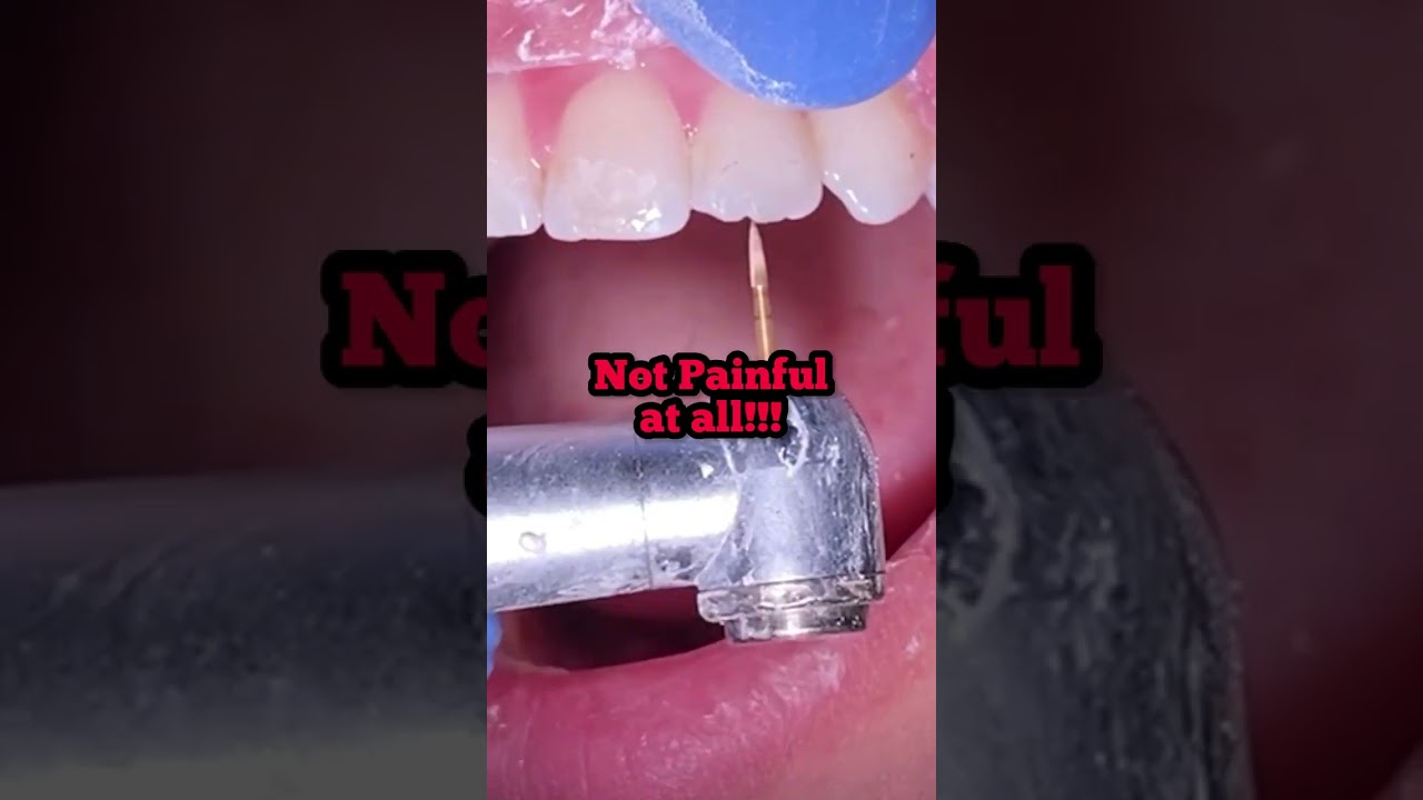 Больно ли снимать брекеты?