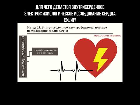 Для чего делается