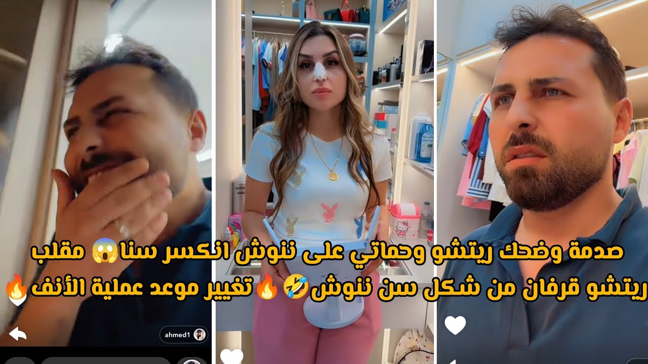 صدمة وضحك ريتشو وحماتي على ننوش انكسر سنا😱 مقلب ريتشو قرفان من شكل سن ننوش🤣🔥تغيير موعد عملية الأنف🔥