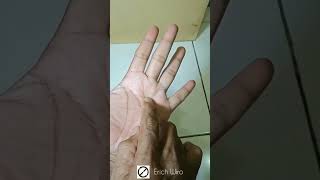 Download Lagu ATASI SAKIT GIGI dengan pijat refleksi #shorts #pijatrefleksi #sakitgigi MP3 Download Lagu ATASI SAKIT GIGI dengan pijat refleksi #shorts #pijatrefleksi #sakitgigi MP3