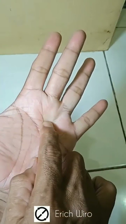 ATASI SAKIT GIGI dengan pijat refleksi #shorts #pijatrefleksi #sakitgigi