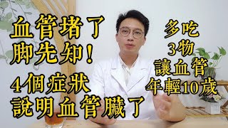 血管堵了腳先知腿腳出現4個“異常”說明血管很髒了多吃“3物”血管年輕10歲預防血栓