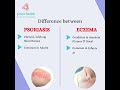Difference between Eczema and Psoriasis