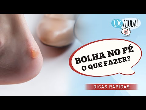 Vídeo: Como prevenir bolhas nos pés: 14 etapas (com fotos)