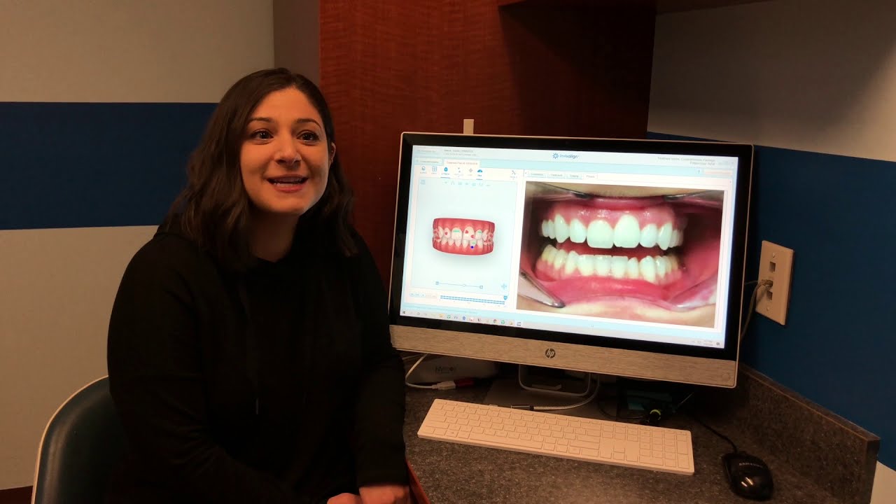 Happy Invisalign Patients at Stamford Dental Arts Ali Modiri DDS - YouTube