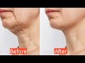 Erase Neck Wrinkles & Lift Sagging Skin | Daily Platysma Massage Routine