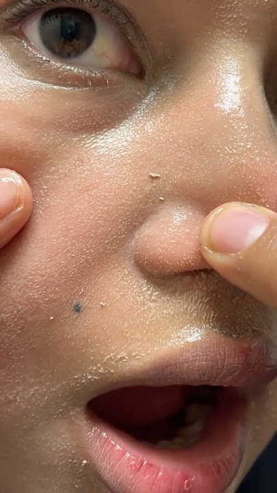 VIRAL Korean Skincare Products fromANUA ✅ #anua#skincare #skincareroutine #koreanskincare #kbeauty