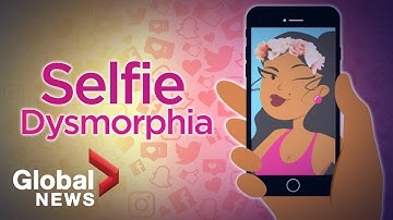 Selfie Dysmorphia: How social media filters are distorting beauty 🤳🏽