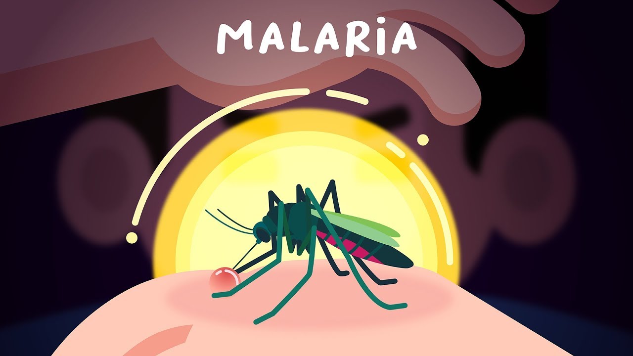 Malaria penyebab 5 Penyebab