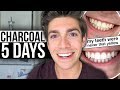 5 Days with ACTIVATED CHARCOAL! Failed Experiment... | david prater VLOG